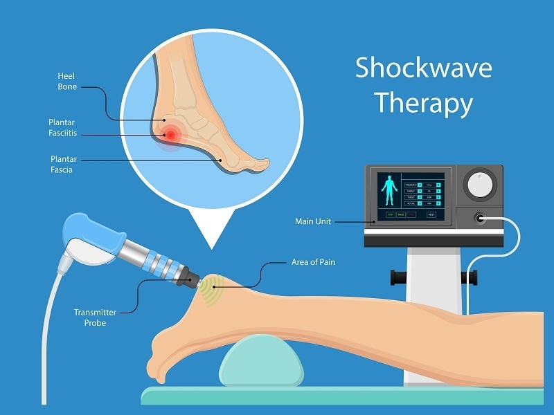 Shockwave Treatment
